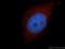 Hydroxymethylbilane Synthase antibody, 14797-1-AP, Proteintech Group, Immunofluorescence image 