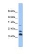 Glutathione S-Transferase Alpha 5 antibody, orb330574, Biorbyt, Western Blot image 