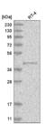 Peptidase M20 Domain Containing 2 antibody, NBP2-56435, Novus Biologicals, Western Blot image 