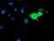 Guanylate Binding Protein 1 antibody, MA5-25692, Invitrogen Antibodies, Immunocytochemistry image 