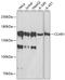CARP1 antibody, A04666, Boster Biological Technology, Western Blot image 