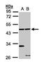Ethanolamine kinase 1 antibody, GTX105887, GeneTex, Western Blot image 