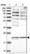 Phosphatidylinositol Glycan Anchor Biosynthesis Class Q antibody, NBP1-83343, Novus Biologicals, Western Blot image 