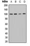 Ectonucleotide Pyrophosphatase/Phosphodiesterase 3 antibody, orb315776, Biorbyt, Western Blot image 