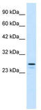 RING1b antibody, TA335664, Origene, Western Blot image 