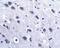 Leucine Rich Repeat And Fibronectin Type III Domain Containing 2 antibody, LS-B14740, Lifespan Biosciences, Immunohistochemistry frozen image 