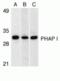 Acidic Nuclear Phosphoprotein 32 Family Member A antibody, TA306130, Origene, Western Blot image 