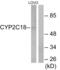 Cytochrome P450 Family 2 Subfamily C Member 8 antibody, abx013985, Abbexa, Western Blot image 