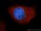 S100 Calcium Binding Protein A6 antibody, 10245-1-AP, Proteintech Group, Immunofluorescence image 