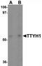 Protein tweety homolog 1 antibody, TA319973, Origene, Western Blot image 