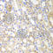 Sirtuin 3 antibody, A7307, ABclonal Technology, Immunohistochemistry paraffin image 