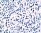 Human papillomavirus type 18 Protein E6 antibody, orb10838, Biorbyt, Immunohistochemistry paraffin image 