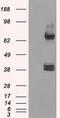 DNA repair protein XRCC4 antibody, GTX83406, GeneTex, Western Blot image 