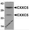 CXXC Finger Protein 5 antibody, 6111, ProSci, Western Blot image 