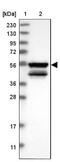 MKS Transition Zone Complex Subunit 1 antibody, NBP1-88692, Novus Biologicals, Western Blot image 