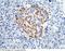 Insulin Receptor antibody, 11081-RP02, Sino Biological, Immunohistochemistry paraffin image 