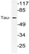 PHF-tau antibody, AP21109PU-N, Origene, Western Blot image 