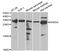 Dehydrogenase/Reductase 9 antibody, A6324, ABclonal Technology, Western Blot image 