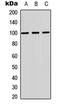 G Protein-Coupled Receptor 143 antibody, orb234865, Biorbyt, Western Blot image 