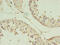 Cobalamin Binding Intrinsic Factor antibody, CSB-PA009417YA01HU, Cusabio, Immunohistochemistry frozen image 
