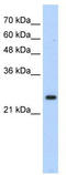 Homeobox protein Hox-B7 antibody, TA335745, Origene, Western Blot image 