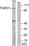 FAST Kinase Domains 1 antibody, LS-B9962, Lifespan Biosciences, Western Blot image 