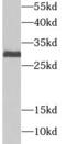 Ubiquitin-conjugating enzyme E2 J2 antibody, FNab09177, FineTest, Western Blot image 