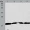 Diablo IAP-Binding Mitochondrial Protein antibody, TA324293, Origene, Western Blot image 