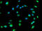 Collagen Type VIII Alpha 1 Chain antibody, A62310-100, Epigentek, Immunofluorescence image 