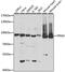 Phosphofructokinase, Muscle antibody, GTX33405, GeneTex, Western Blot image 