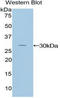 NFKB Inhibitor Delta antibody, LS-C294624, Lifespan Biosciences, Western Blot image 