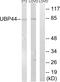 Ubiquitin Specific Peptidase 44 antibody, PA5-39516, Invitrogen Antibodies, Western Blot image 