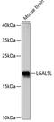 Galectin Like antibody, GTX66304, GeneTex, Western Blot image 