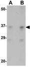 SRY-Box 2 antibody, GTX31797, GeneTex, Western Blot image 