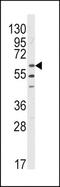 LYN Proto-Oncogene, Src Family Tyrosine Kinase antibody, TA324977, Origene, Western Blot image 