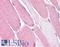 Bestrophin 3 antibody, LS-A8638, Lifespan Biosciences, Immunohistochemistry paraffin image 
