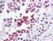 TP53 Regulating Kinase antibody, 51-600, ProSci, Immunohistochemistry frozen image 