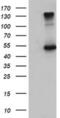 EGF Containing Fibulin Extracellular Matrix Protein 1 antibody, MA5-25740, Invitrogen Antibodies, Western Blot image 