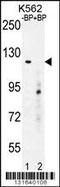 DEP Domain Containing 5 antibody, 56-172, ProSci, Western Blot image 