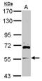 ADP Ribosylation Factor GTPase Activating Protein 2 antibody, NBP2-15441, Novus Biologicals, Western Blot image 