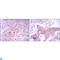 Forkhead Box D3 antibody, LS-C812604, Lifespan Biosciences, Immunohistochemistry paraffin image 