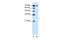 Low affinity sodium-glucose cotransporter antibody, GTX46815, GeneTex, Western Blot image 