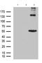 Tumor Protein P63 antibody, LS-C800122, Lifespan Biosciences, Western Blot image 