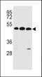 Kringle Containing Transmembrane Protein 2 antibody, LS-C165609, Lifespan Biosciences, Western Blot image 