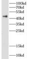 DNA Fragmentation Factor Subunit Alpha antibody, FNab02347, FineTest, Western Blot image 