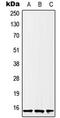 H2B Histone Family Member S antibody, MBS821822, MyBioSource, Western Blot image 