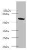 Proteasome Subunit Beta 4 antibody, A52715-100, Epigentek, Western Blot image 