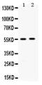 Aldehyde Dehydrogenase 3 Family Member A2 antibody, PA5-78758, Invitrogen Antibodies, Western Blot image 