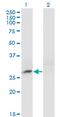 Crystallin Beta B3 antibody, MA5-24386, Invitrogen Antibodies, Western Blot image 