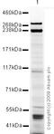 Desmoplakin antibody, ab71690, Abcam, Western Blot image 